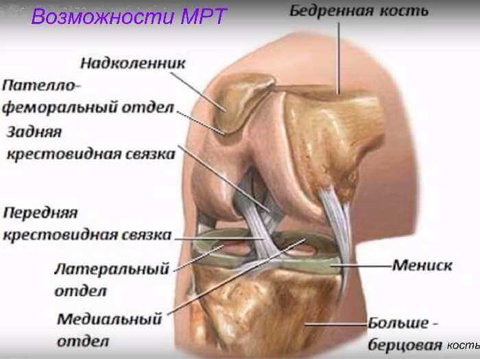 мрт суставов что показывает, почему мрт мрт суставов что показывает, почему мрт